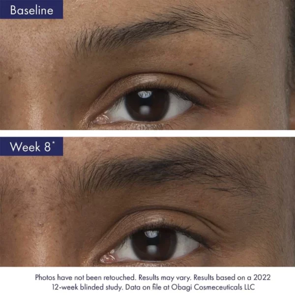 Obagi Nu-Cil™ Eyebrow Boosting Serum - Image 2