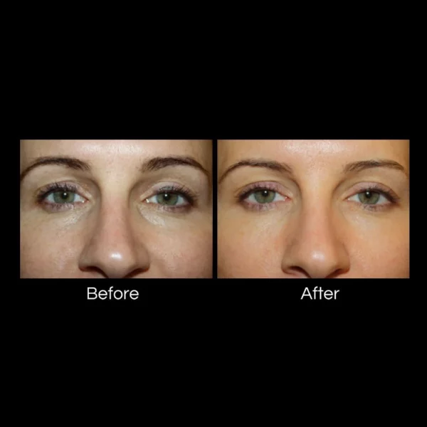 colorescience® SUNFORGETTABLE® TOTAL PROTECTION™ BRUSH-ON SHIELD SPF 50 - Image 2