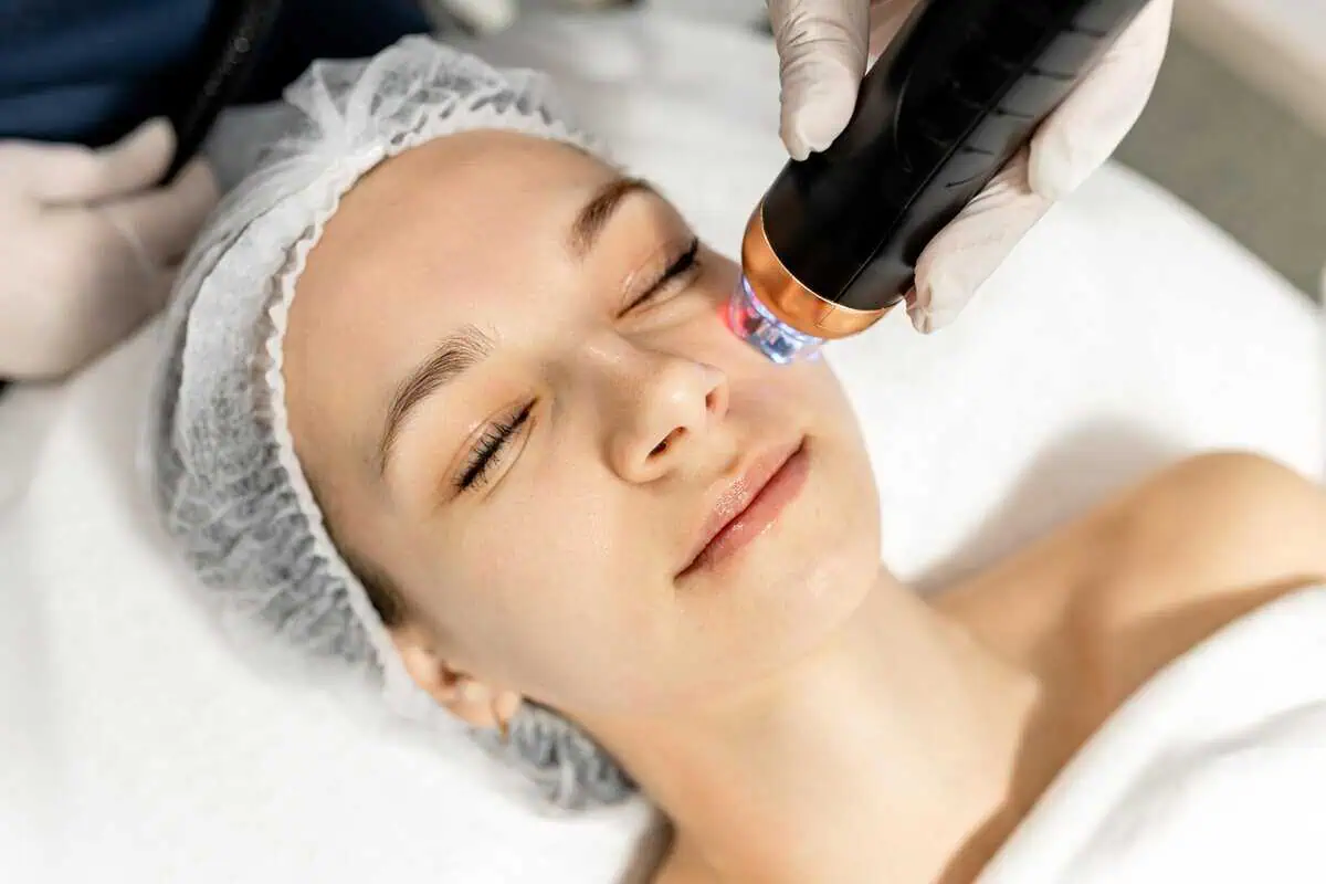 Woman receiving RF Microneedling at Aesthetic Center of Richmond Dermatology in Glen Allen, VA