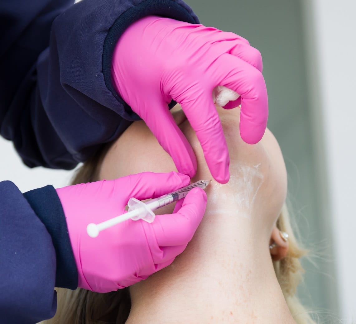 Great concept of Kybella - aesthetic treatment of jowls, injection of deoxycholic acid. | Aesthetic Center of Richmond Dermatology in Medical spa in Glen Allen, VA